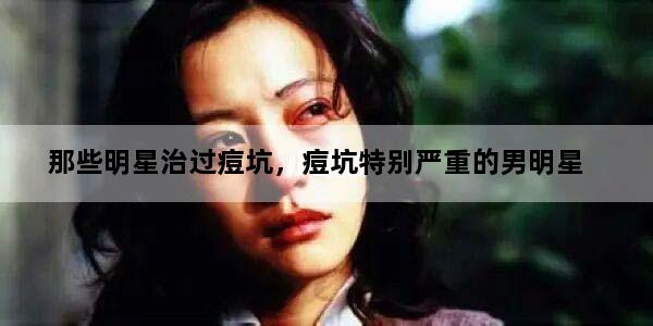 那些明星治过痘坑，痘坑特别严重的男明星